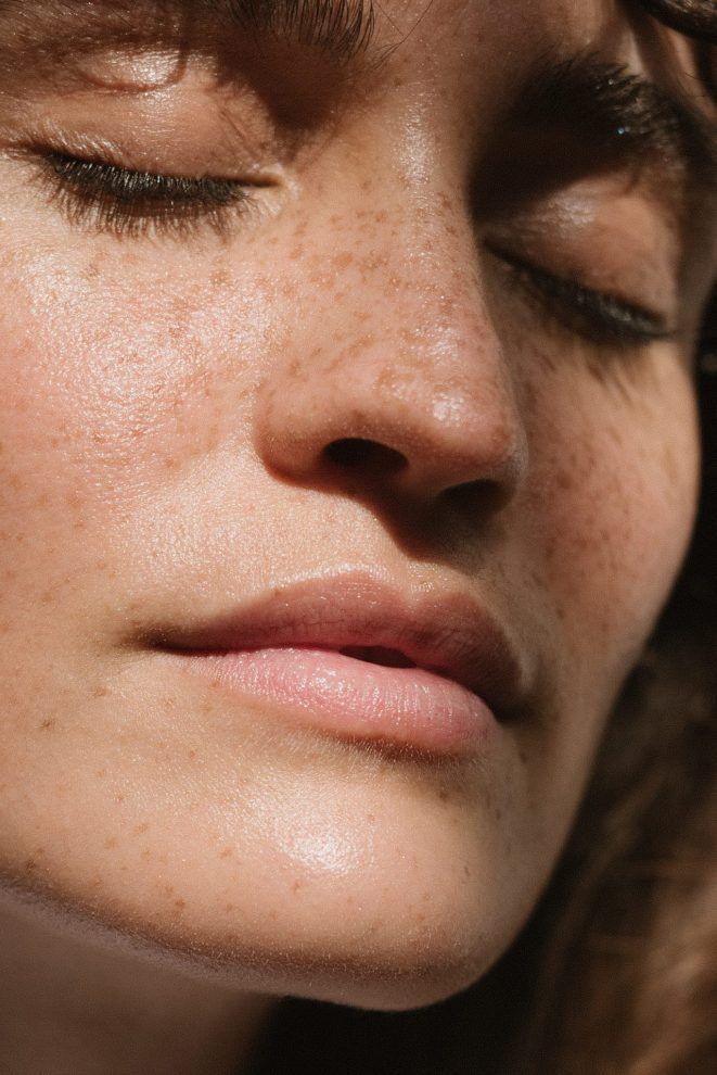 Blackheads/Pores