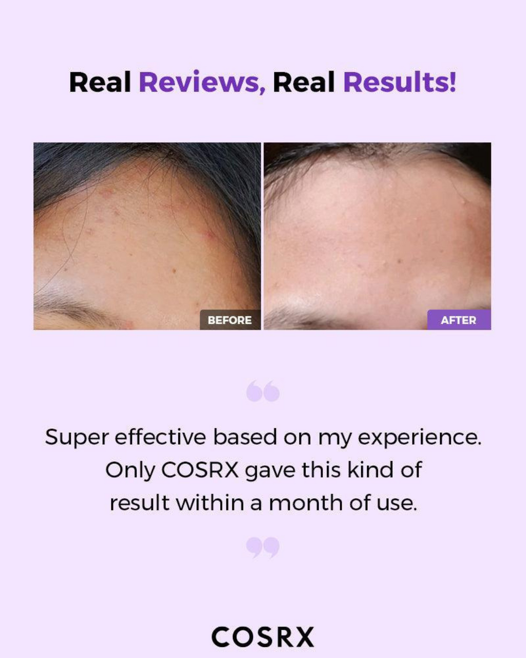 COSRX AHA/BHA Clarifying Treatment Toner
