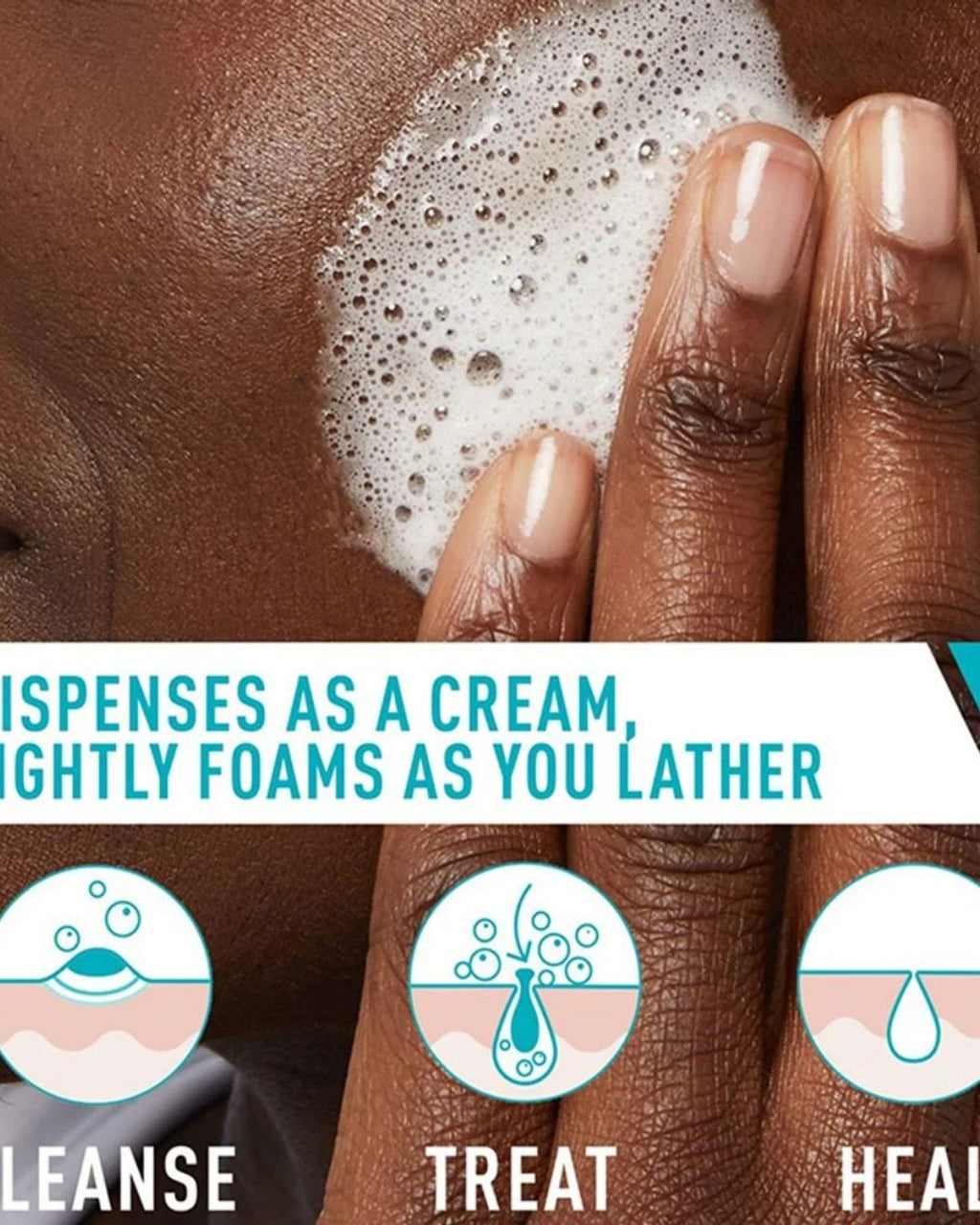 Cerave Acne Foaming Cream Cleanser